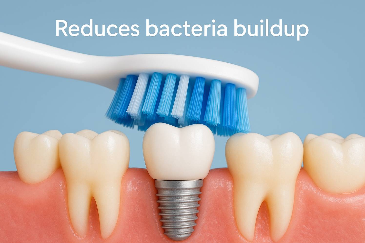 Benefits Of Dental Implants For Long-Term Oral Health